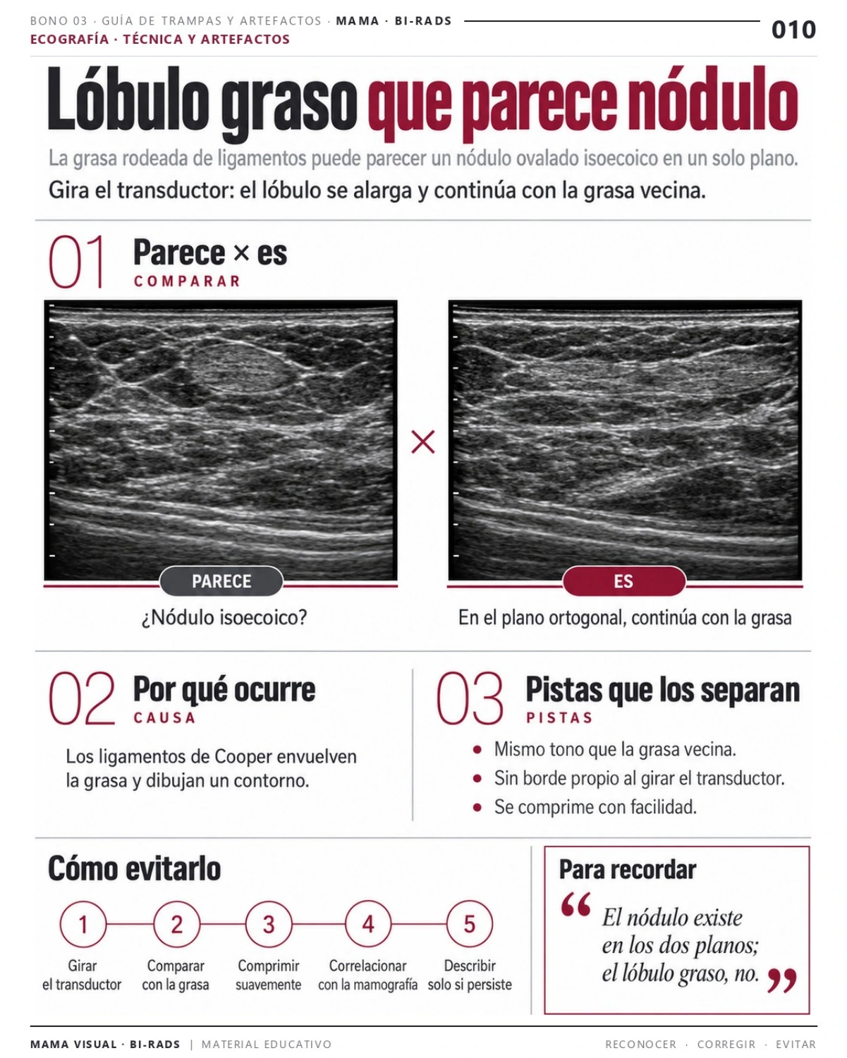Página 10: Lóbulo de grasa que parece un nódulo. Vista previa del PDF Mama Visual BI-RADS; imágenes didácticas simuladas.