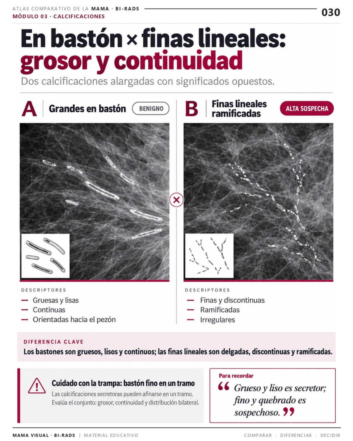 Página 30: Calcificaciones: grosor y continuidad. Vista previa del PDF Mama Visual BI-RADS; imágenes didácticas simuladas.