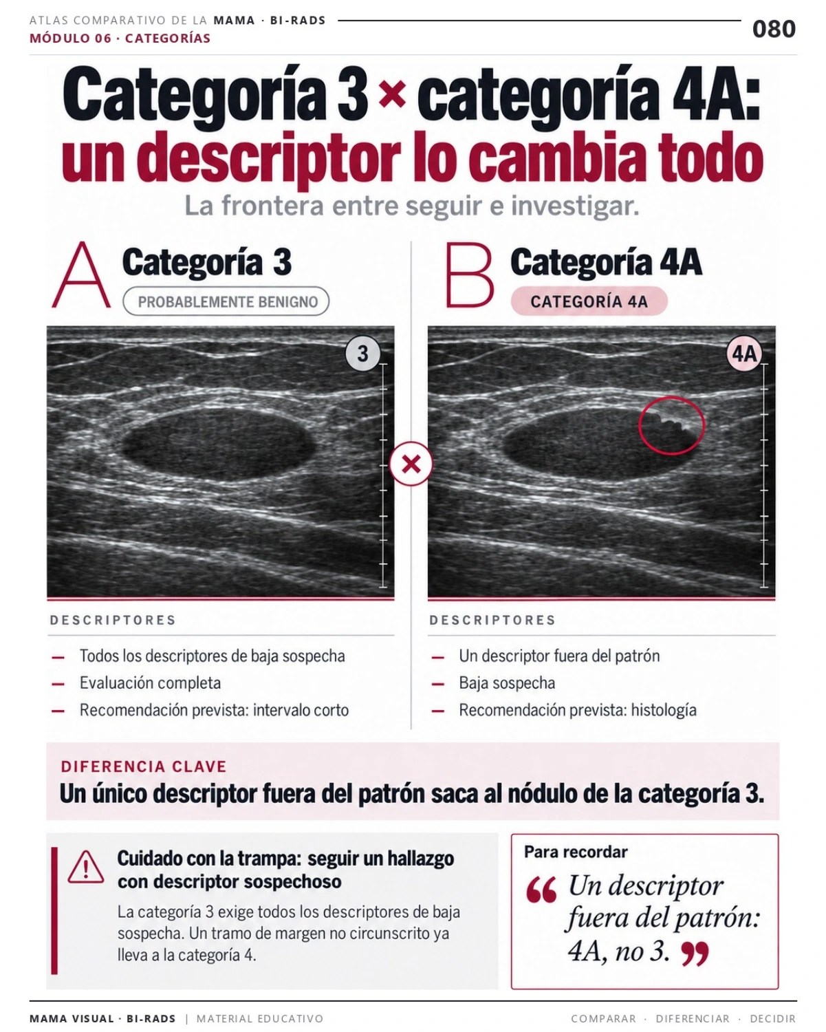 Página 80: Categoría 3 × categoría 4A. Vista previa del PDF Mama Visual BI-RADS; imágenes didácticas simuladas.