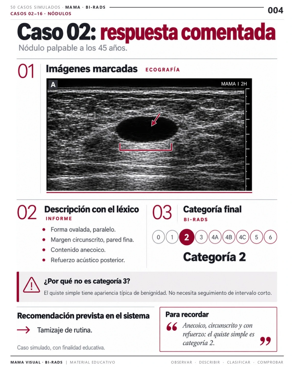 Página 4: Caso 02: respuesta comentada. Vista previa del PDF Mama Visual BI-RADS; imágenes didácticas simuladas.