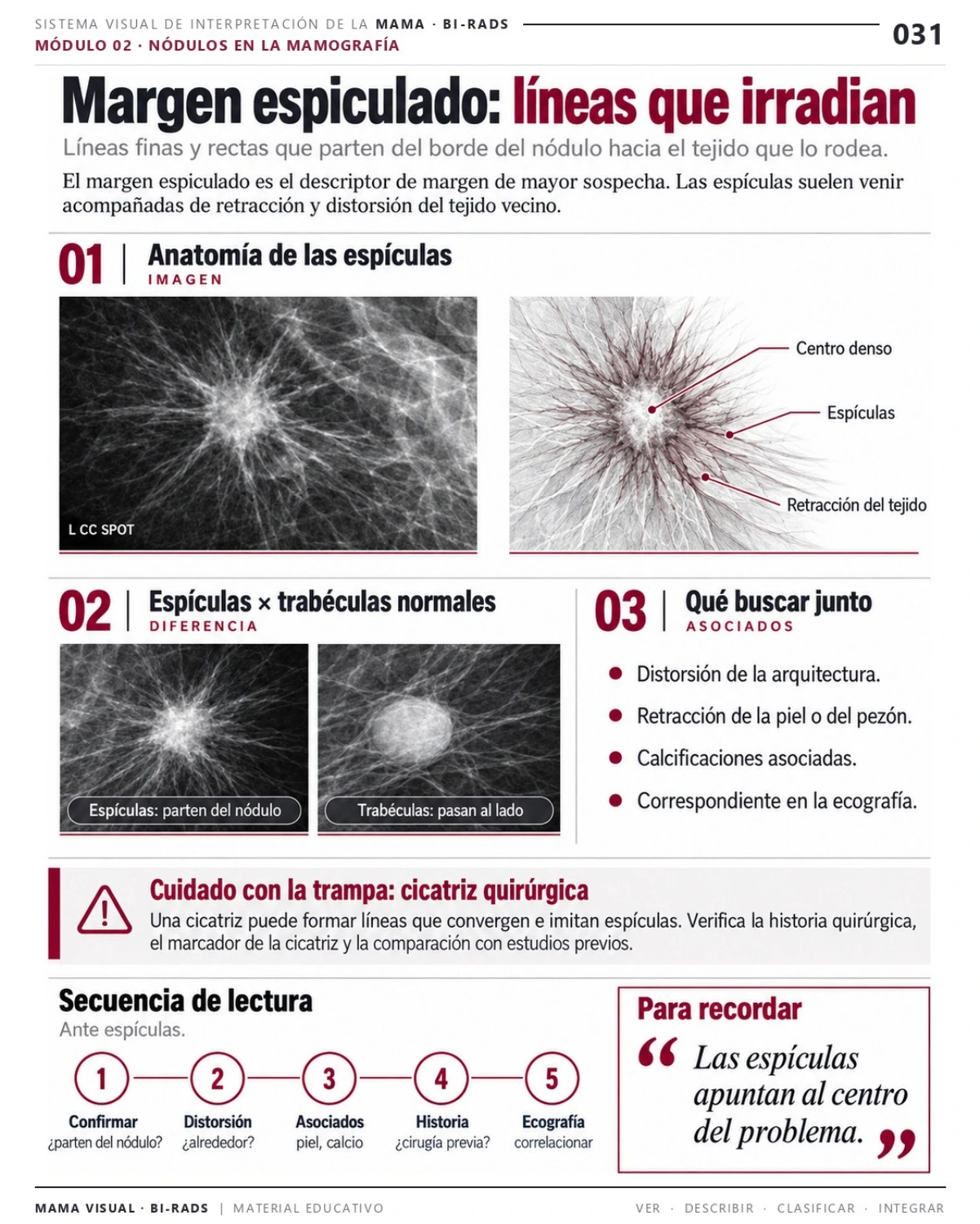Página 31: Margen espiculado: líneas que irradian. Vista previa del PDF Mama Visual BI-RADS; imágenes didácticas simuladas.